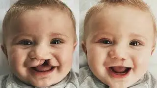Лекция доцента,к.м.н.,зав. ЧЛХ БелМАПО Гричанюка Д.А.