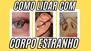 CORPO ESTRANHO: Como lidar com Corpo Estranho no Nariz, Olho e Ouvido