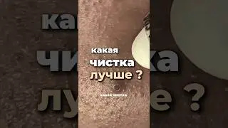 Какая чистка кожи лучше ? Вакуум ,ультразвук , механическая ,гайд по уходу в лс