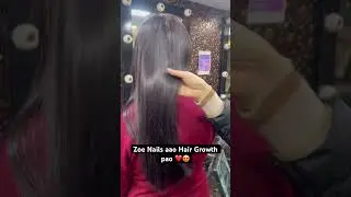 Zoe Nails aao Hair Growth pao ❤️😍 