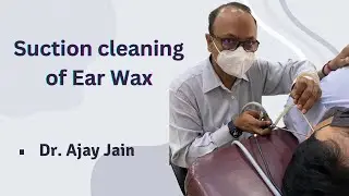 Suction cleaning of ear wax |.