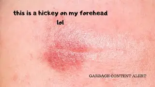4HEAD HICKEY ASMR