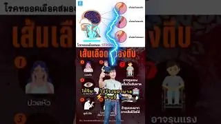 อัมพฤกษ์ ☢️ อัมพาต 🏥 โรคเส้นเลือดในสมอง 🧠 ตีบ 🩸 ตัน ❤️‍🩹 แตก 💥#หมอชมพู่ #โรงพยาบาลมะขาม