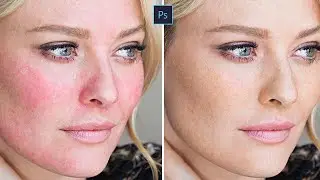 Как УБРАТЬ КРАСНОТУ с ЛИЦА В ФОТОШОП | УРОК ПО PHOTOSHOP ЗА 30 СЕКУНД 🔥
