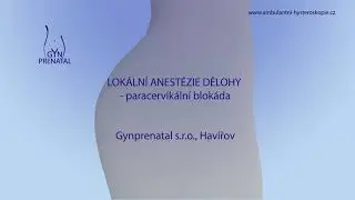 Lokální anestézie dělohy - paracervikální blokáda