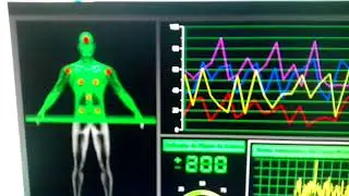 Analizador cuántico de resonancia  magnético