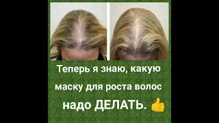 Супер маска для РОСТА ВОЛОС и против ВЫПАДЕНИЯ.