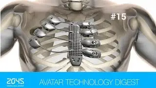 #15 Avatar Technology Digest / Human head transplant edges closer to reality / Robot for asteroids