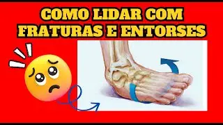 COMO LIDAR COM FRATURAS E ENTORSES
