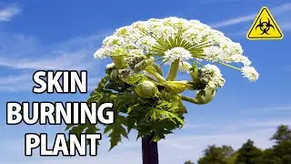 This Plant Will Melt Your Skin (CampAesthetics Extra)