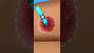 Parasite Cleaner 29/1 New Gameplay all levels.