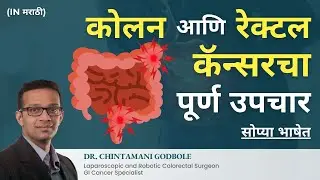 Colon Cancer Treatment | कोलन कर्करोगाची Surgery | Dr. Godbole - Jaslok Hospital (मराठी)