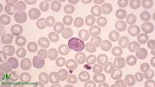 What Does a Low White Blood Cell Count Mean?
