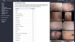 Medication Adverse Events