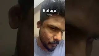 Before Vs After 🙏🏻 