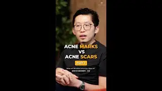 Acne Marks vs Acne Scars Part 2 | Ensoul Medical Clinic