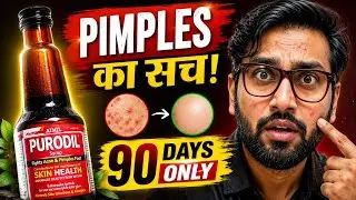 Purodil Syrup | Pimples, skin problem | अब चेहरा करेगा सबका ग्लो  #face #ayurveda #pimples #natural