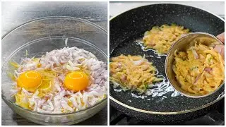 If You Make This Recipe of Onion Everyone will Love This | Onion Potato Snacks Recipe | New Snacks