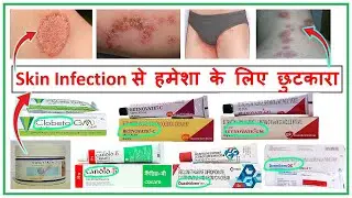 दाद खाज खुजली की सबसे अच्छी क्रीम ll Betnovate cream ll Quadiderm ll Clobeta gm ll Dermiford ll