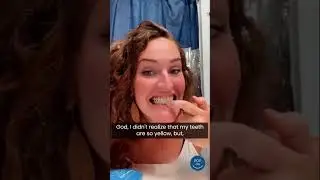 These pop-on veneers give you a perfect smile in SECONDS!  *MUST WATCH*