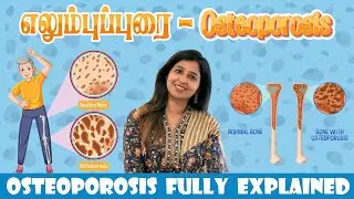 Osteoporosis  Explained by Dr.Sharmika | #daisyhospital #osteoporosis #cure #tips #bodypainrelief