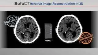 SafeCT Iterative 3D Image Reconstruction—Universal Add-on System for CT Scanners