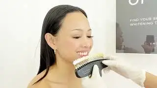 Fastest and most effective teeth whitening in Manila