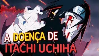 A DOENÇA DE ITACHI UCHIHA - Qual a causa de sua MORTE? - Fred | Anime Whatever