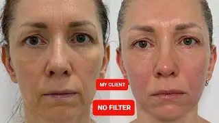FACE LIFTING Massage Tutorial for everyone