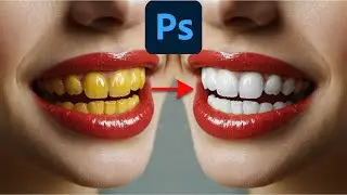 Teeth Retouching in photoshop #photoshop #graphicdesigne #photoshopeffects #teeth #retouching