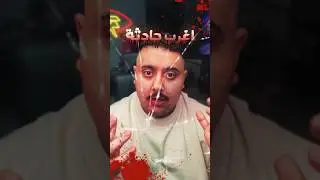 أغرب حادثة ينجو منها انسان بالعالم 😱