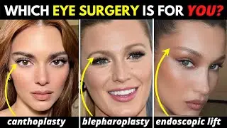 Blepharoplasties 101: Which eye surgery will make YOU look younger?