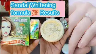 Whitening cream /Formula cream for whitening |Sandal cream & Arena gold cream |whitening capsule
