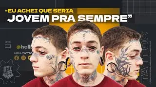 A surpreendente história de Akkira | Remoção de Tatuagem