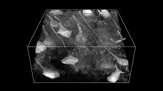 3D image of brain nerve fibers in Thy1-YFP mice using SLM two-photon microscopy