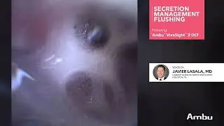 How to Clean the VivaSight™ 2 DLT Camera from Secretions