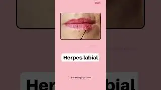 Spanish Vocabulary - Skin Conditions! #learnspanish