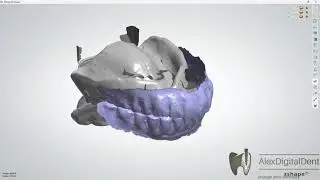 Сканирование съемных протезов и создании модели  Meshmixer & 3shape