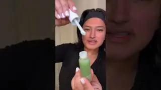 Acne Treatment using Ogee’s Targeted Blemish Treatment 💚