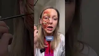 Куда нельзя колоть ботокс?