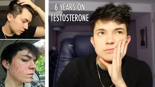 My Worst Testosterone Experiences (FTM)