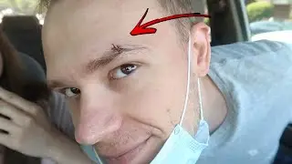 HOW DID I MANAGE TO BREAK MY EYEBROW?