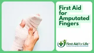 First Aid for Bruised or Amputated Fingers