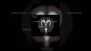 Lateral ventricles from anterior view #shorts  #science #anatomy #doctor