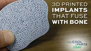 Cranial Implant 3D Printed From a Biocompatible Ceramic | The Cool Parts Show