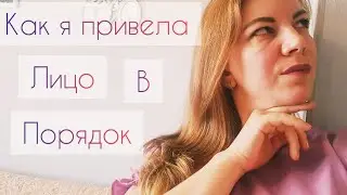 УХОД ЗА ЖИРНОЙ КОЖЕЙ/КАК ИЗБАВИЛАСЬ ОТ АКНЕ И КОМЕДОНОВ