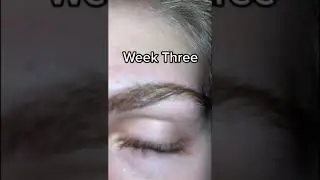 Eyelashes Real Results🦋Eyelashes Before and After✨Eyelash Transformation🌊Thicker EyelashesFor $34.00