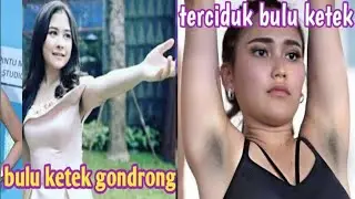 Forgot to shave their armpits, a group of artists were caught with armpit hair.