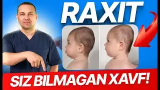 Raxit Kasalligi Bolalarda: Belgilari, Sabablari va Davosi | Vitamin D va Kalsiy Qanchalik Muhim?