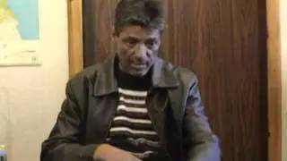 13 Чернодробна цироза Явор